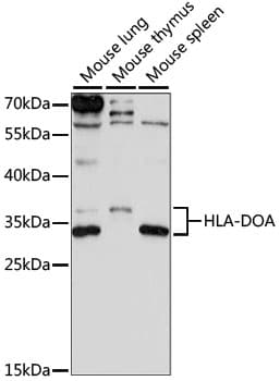 Polyclonal Rabbit anti-Human HLA-DOA Antibody (WB)