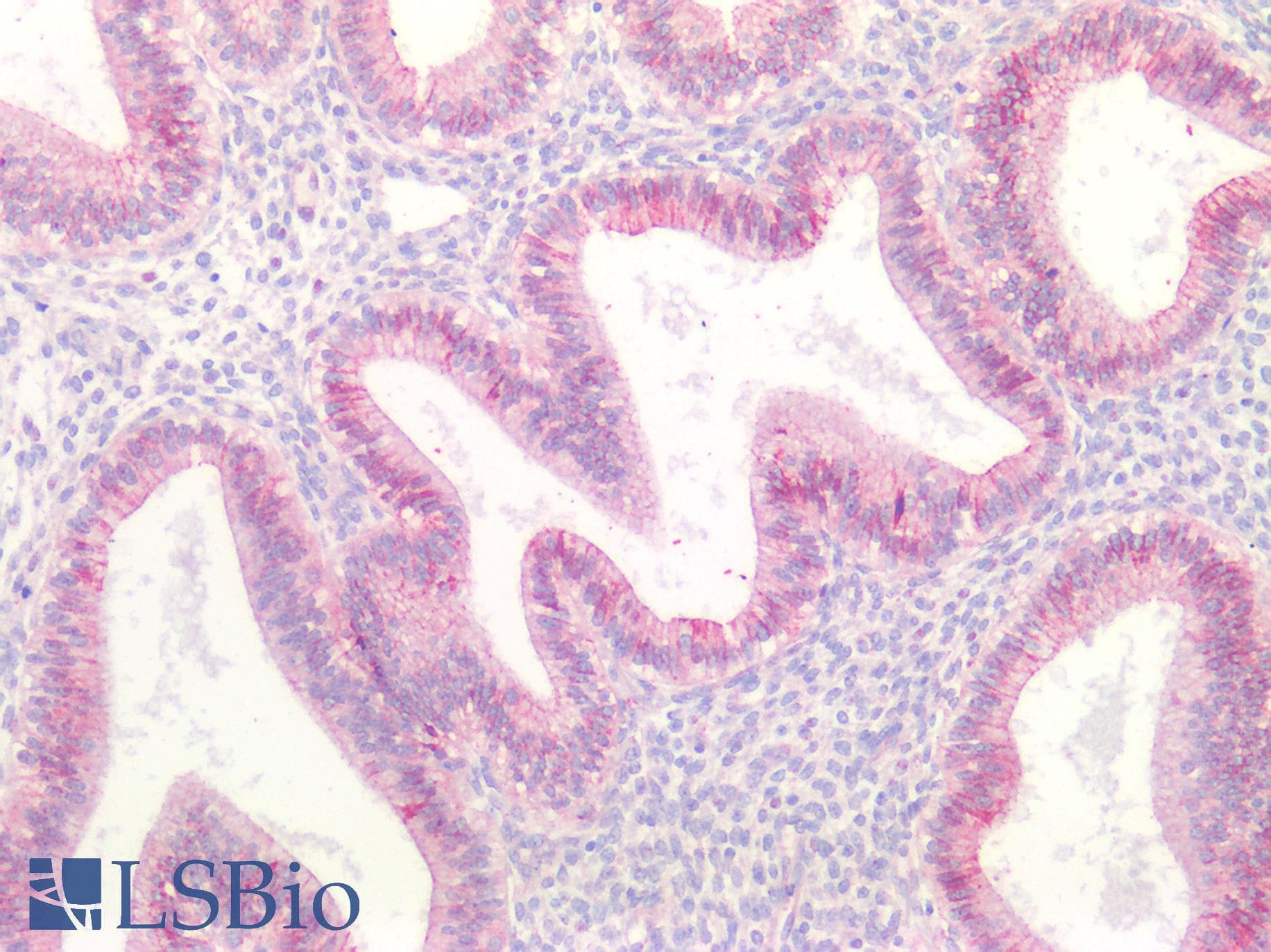 PathPlus™ Polyclonal Rabbit anti-Human CTNND1 / p120 Catenin Antibody (IHC)