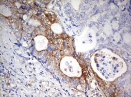 PARN Antibody (aa1-266, clone OTI4D12)