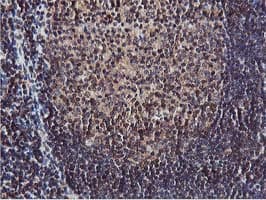 AKT1 Antibody (clone OTI4G4)