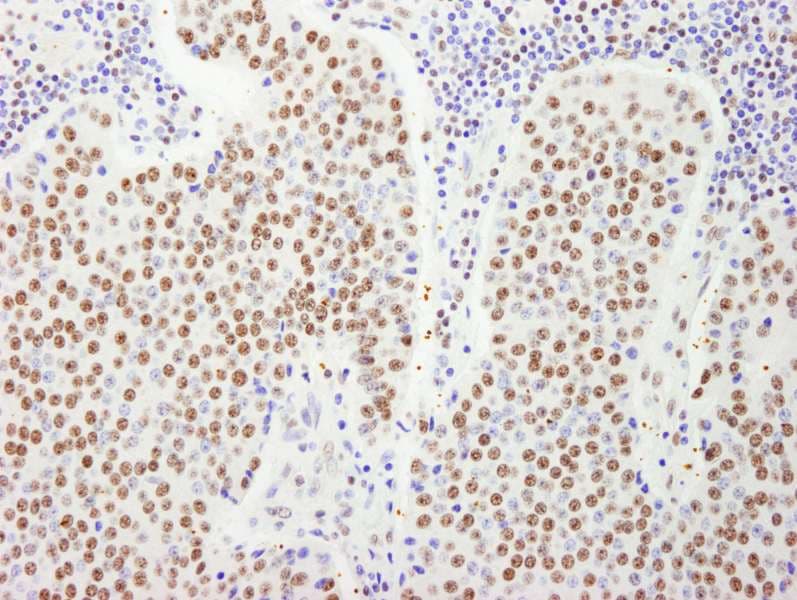 HFip1 / FIP1L1 Antibody (aa1-50)