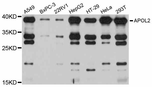 Polyclonal Rabbit anti-Human APOL2 / Apolipoprotein L 2 Antibody (WB)