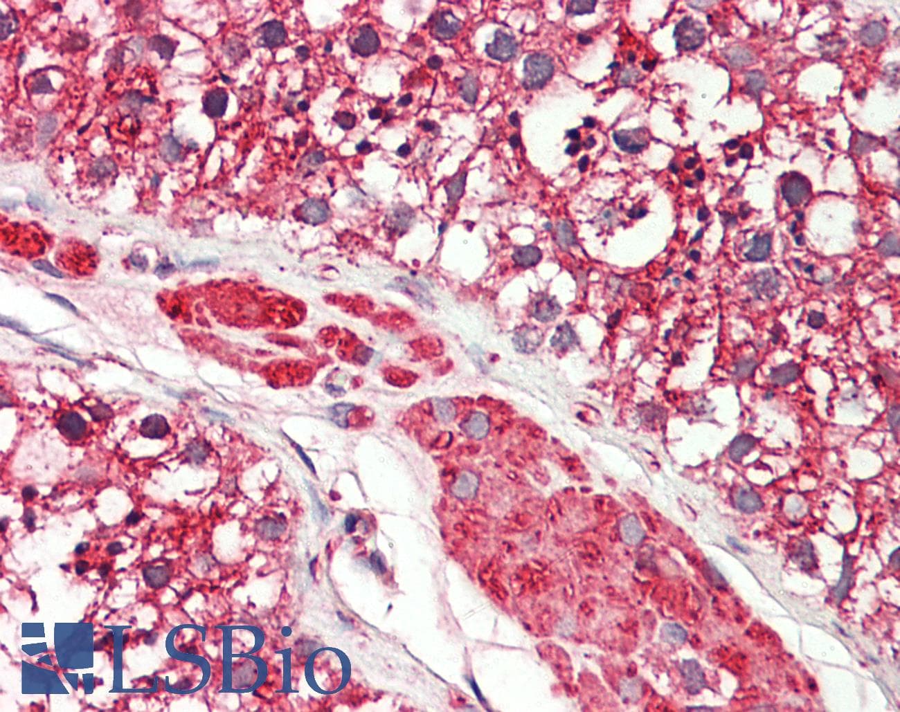 IHC-plus™ CYB5R3 / B5R Antibody