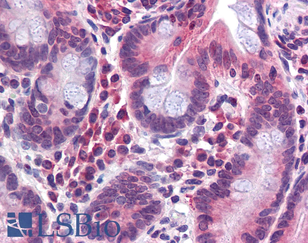 IHC-plus™ Polyclonal Rabbit anti-Human TMPRSS4 Antibody (N-Terminus, IHC)