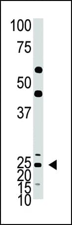 ASCL1 / MASH1 Antibody (aa166-196)