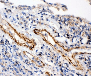 IKBKB / IKK2 / IKK Beta Antibody