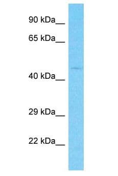 Polyclonal Rabbit anti-Human FBXW5 Antibody (aa121-170, WB)