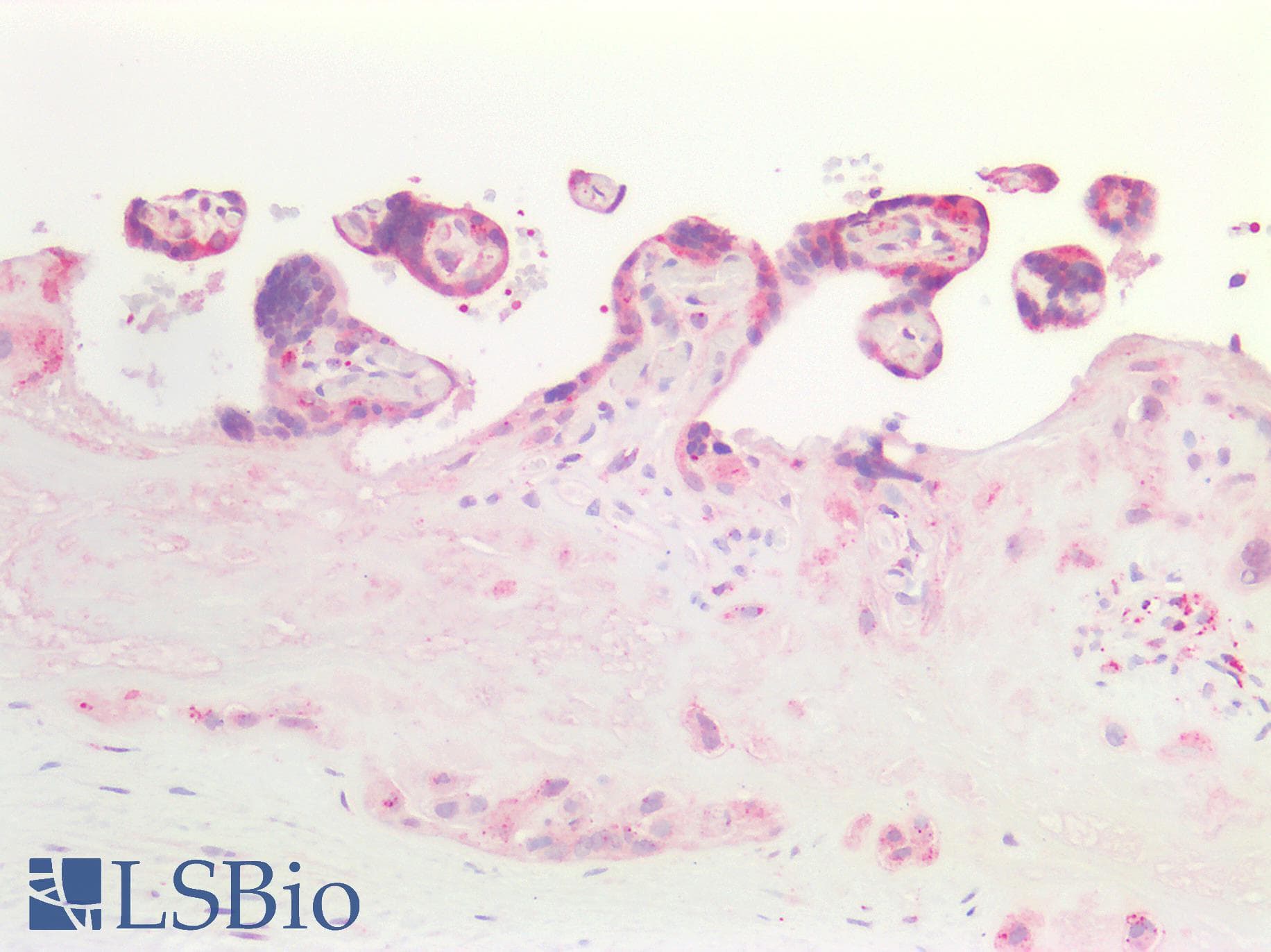 PathPlus™ Polyclonal Rabbit anti-Human HEXB Antibody (aa481-530, IHC, WB)
