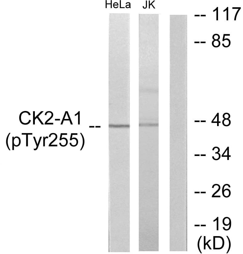 CSNK2A1 Antibody (phospho-Tyr255)