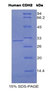 Human CDH2 / N Cadherin Protein (Recombinant His)