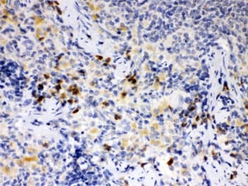 Polyclonal Rabbit anti-Human ATG14 Antibody (IHC, WB)
