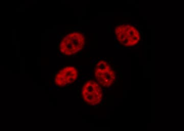 Polyclonal Rabbit anti-Human POLR1B Antibody (IHC, IF, WB)