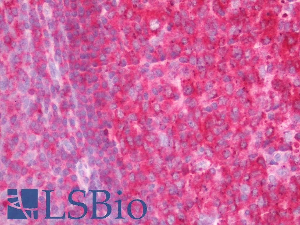 IHC-plus™ HLA-DPB1 Antibody (clone 6C6)