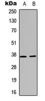 CD1D Antibody (Internal)