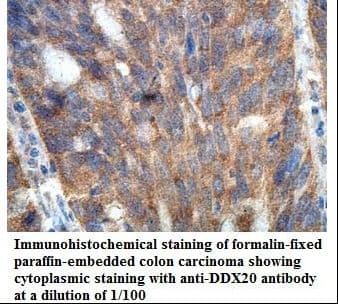 DDX20 / GEMIN3 Antibody (aa556-793)