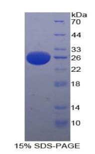 Human PAFAH1B3 Protein (Recombinant His-T7)