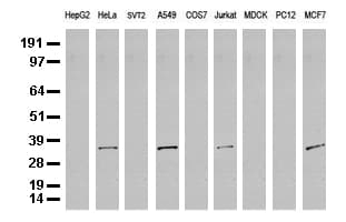 SDCBP / Syntenin Antibody (clone UMAB69)