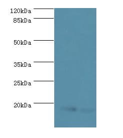 UBE2D1 / UBCH5 Antibody