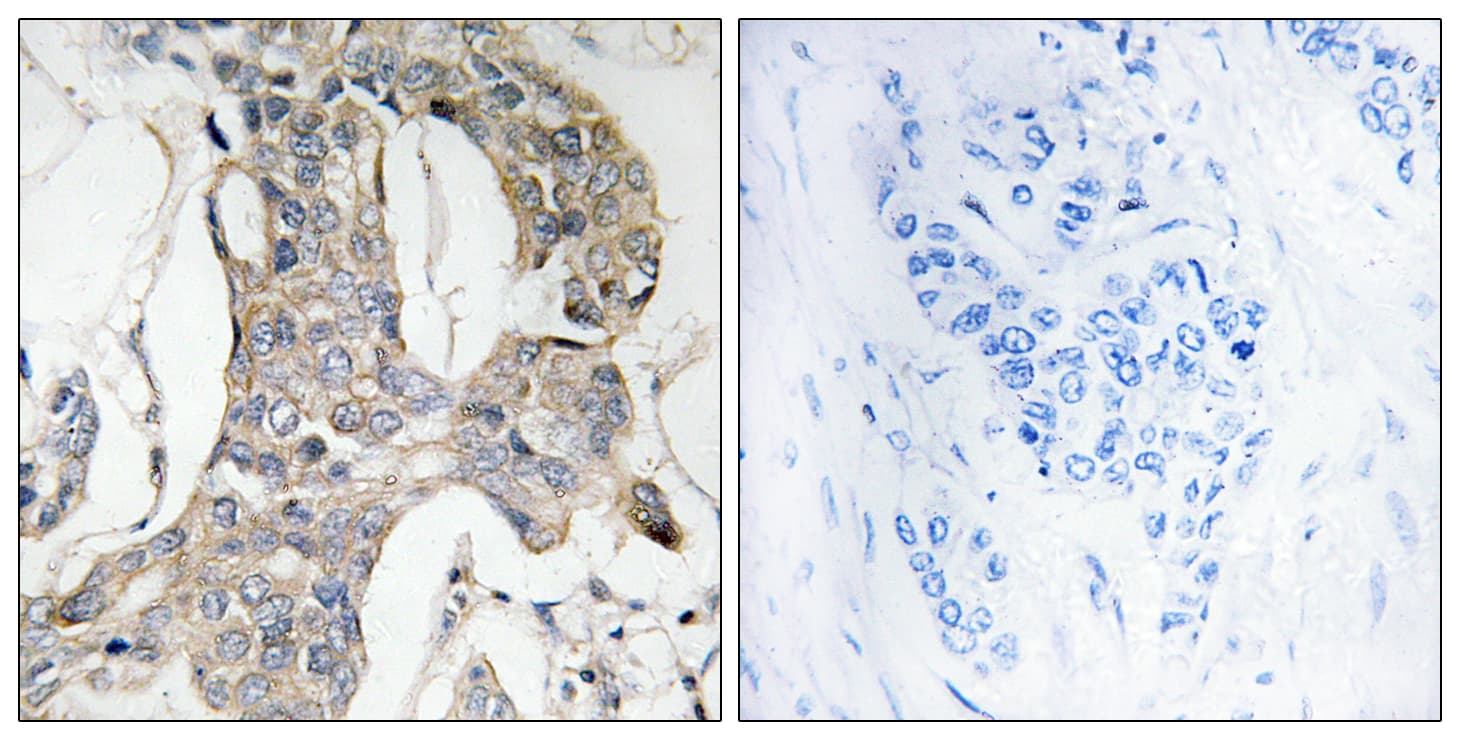 DUSP1 / MKP1 Antibody (phospho-Ser296/Ser318)