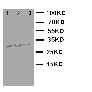 BIRC5 / Survivin Antibody (aa1-142)