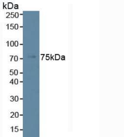 PLCB2 Antibody