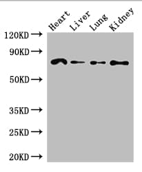 Polyclonal Rabbit anti-Human FZD8 / Frizzled 8 Antibody (IHC, WB)