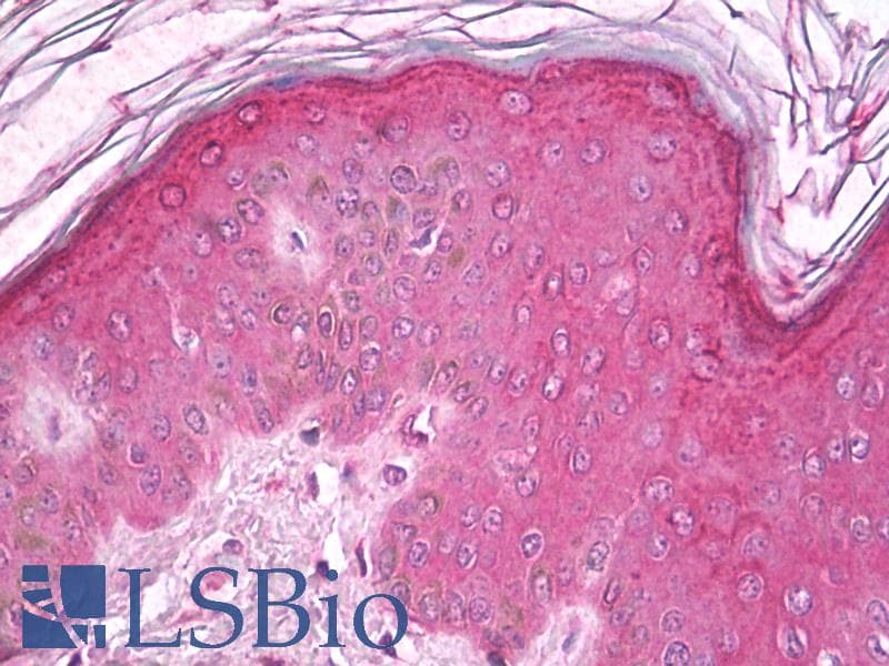 IHC-plus™ ERK1 + ERK2 Antibody