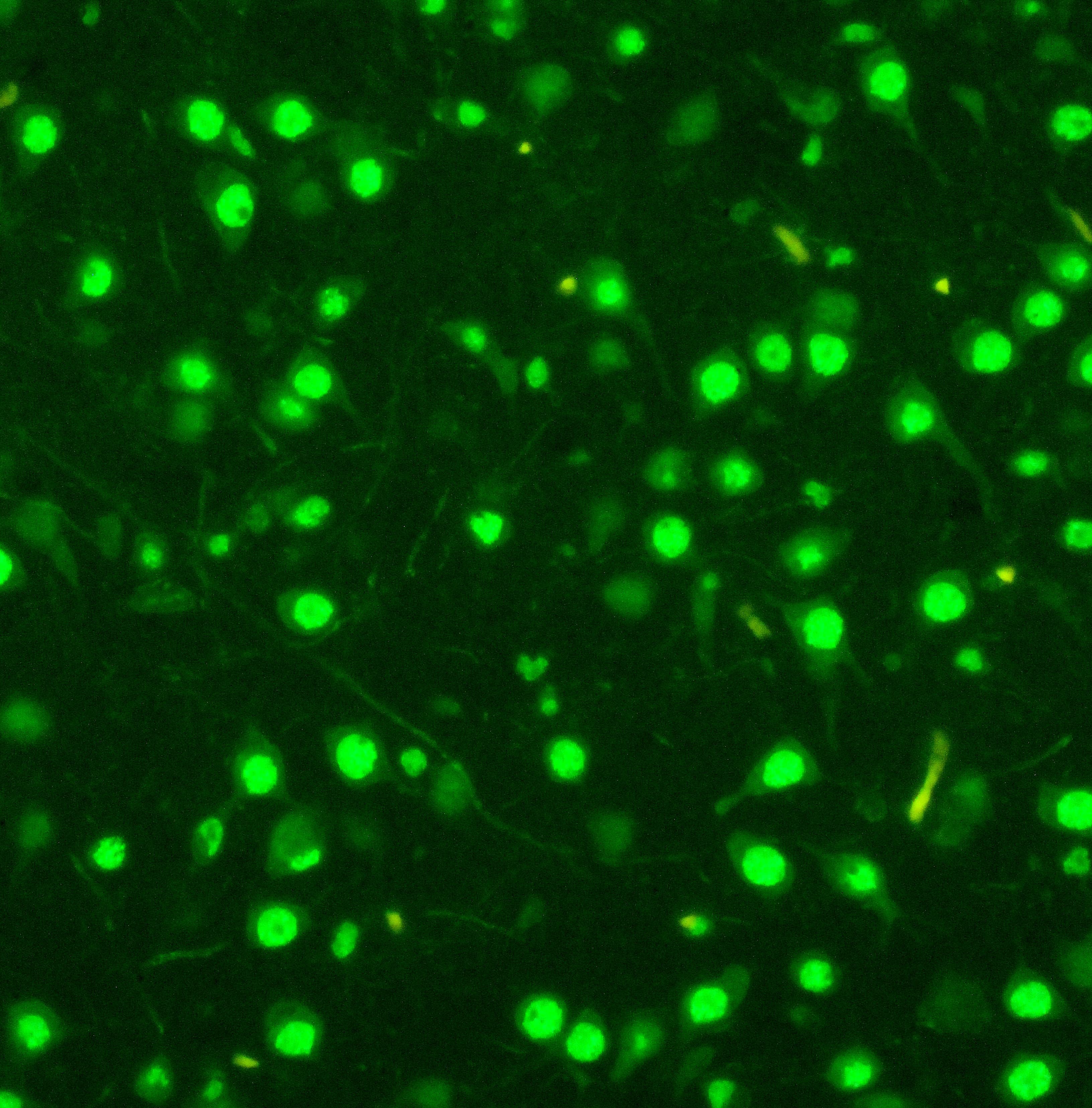 Polyclonal Rabbit anti-Human MCM2 Antibody (aa889-904, IHC, WB)