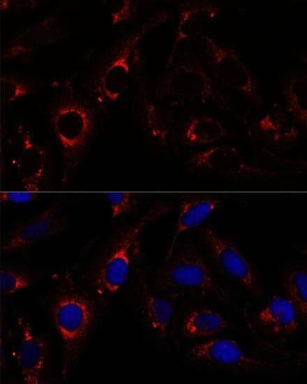 RNF112 / ZNF179 Antibody
