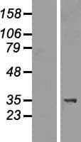 TIPRL / TIP Protein (Over-Expression Lysate Myc-DDK (Flag))