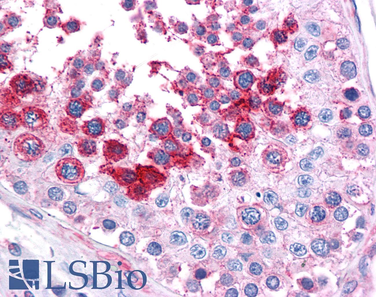 IHC-plus™ LST1 Antibody (clone LST1/02)
