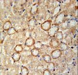 CRB2 Antibody (aa1258-1285)