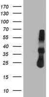 TIMP2 Antibody (clone OTI1B11, Carrier-free)
