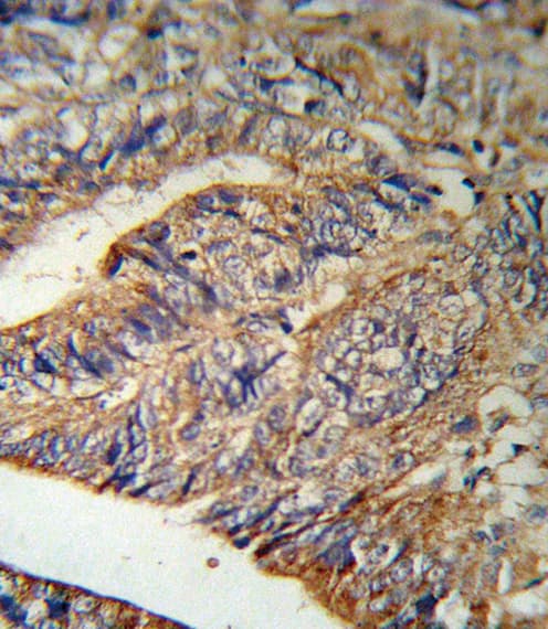 IL1RN Antibody (aa100-129)