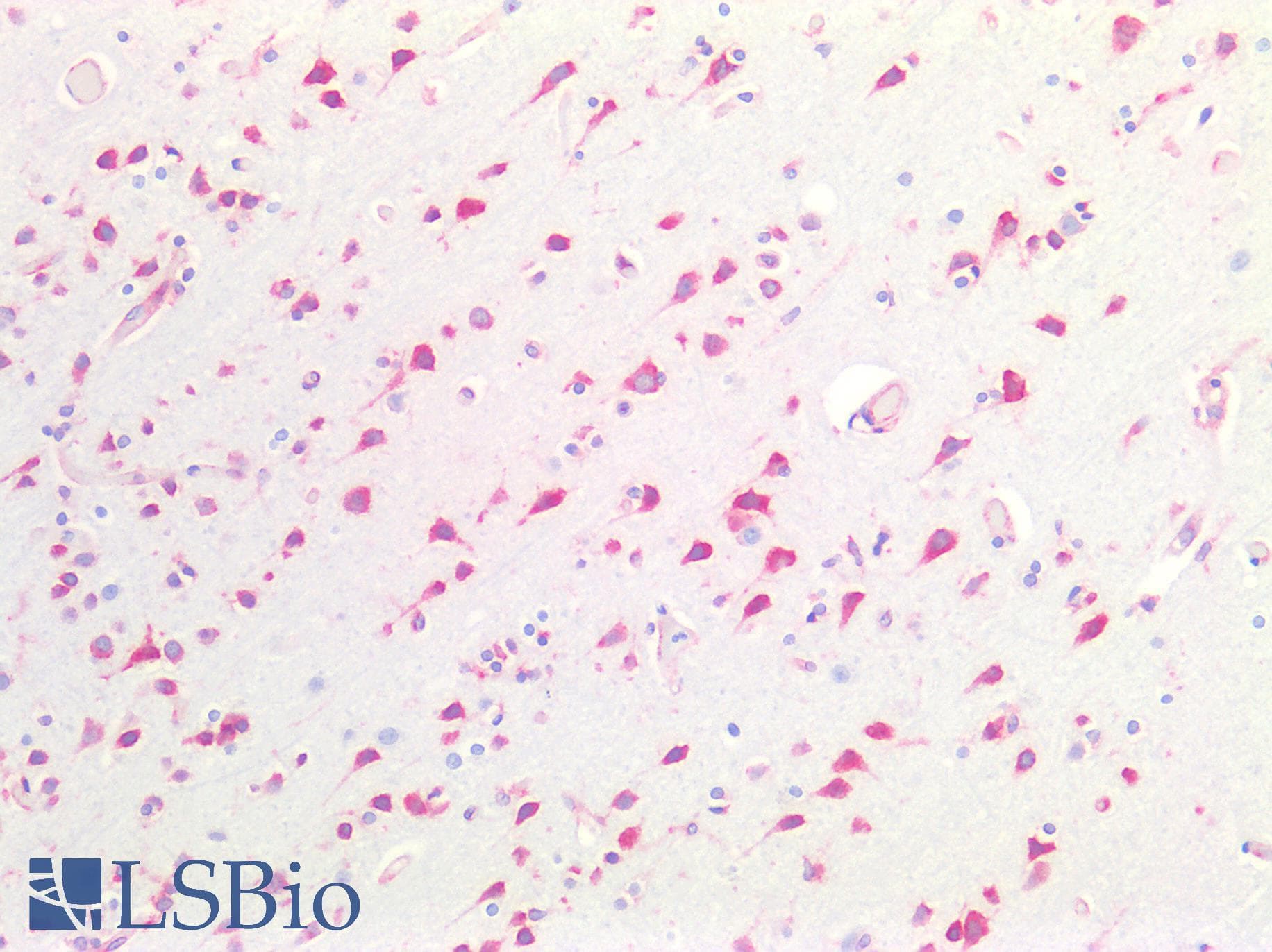 PathPlus™ CTSV / Cathepsin V Antibody (Internal)