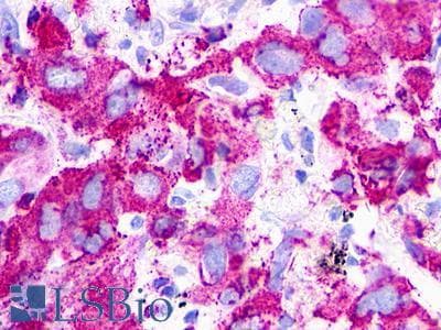 PathPlus™ Polyclonal Rabbit anti-Human P2RY1 / P2Y1 Antibody (Extracellular Domain, IHC)