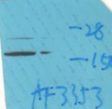 Polyclonal Rabbit anti-Human CALM3 / Calmodulin 3 Antibody (phospho-Thr79,phospho-Ser81, IHC, IF, WB)