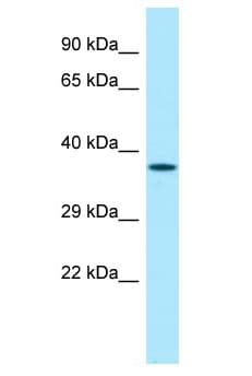 Polyclonal Rabbit anti-Mouse ZNF185 Antibody (aa51-100, WB)