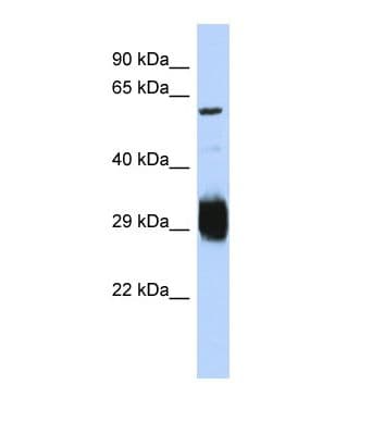 Polyclonal Rabbit anti-Human SETMAR Antibody (C-Terminus, WB)