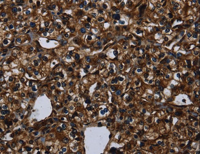 Polyclonal Rabbit anti-Human KLK14 / Kallikrein 14 Antibody (IHC, WB)