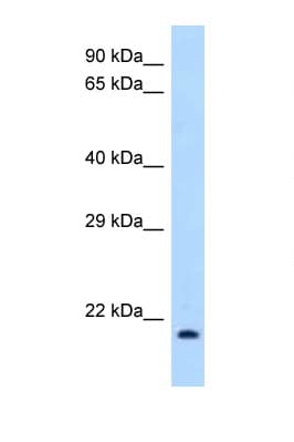 IL1RN Antibody (N-Terminus)