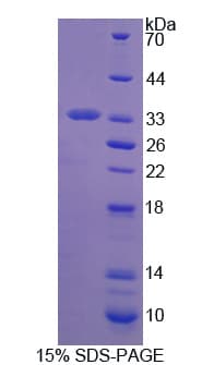 Rat ZP2 Protein (Recombinant His)