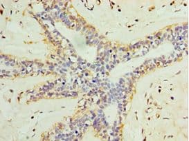 Polyclonal Rabbit anti-Human L3MBTL1 Antibody (aa513-752, IHC)