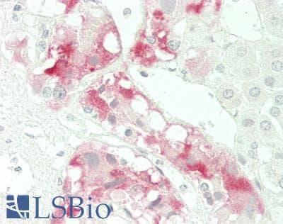 IHC-plus™ MDK / Midkine Antibody