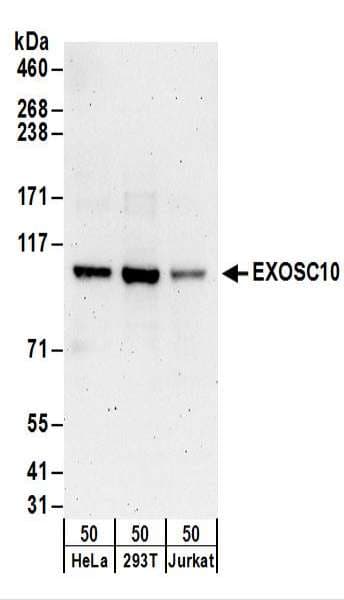 EXOSC10 Antibody (aa835-885)