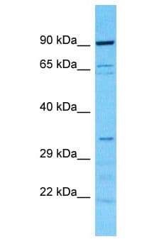 Polyclonal Rabbit anti-Human CAB39L Antibody (aa221-270, WB)