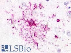 PathPlus™ GPR52 Antibody (Cytoplasmic Domain)