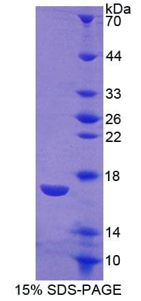 Rat CALCR / Calcitonin Receptor Protein (Recombinant His-T7)