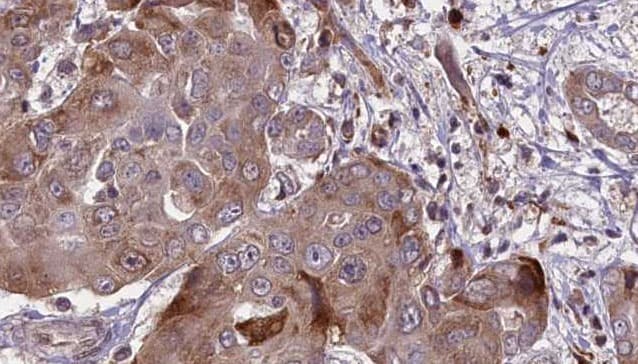 CAPN1 / Calpain 1 Antibody