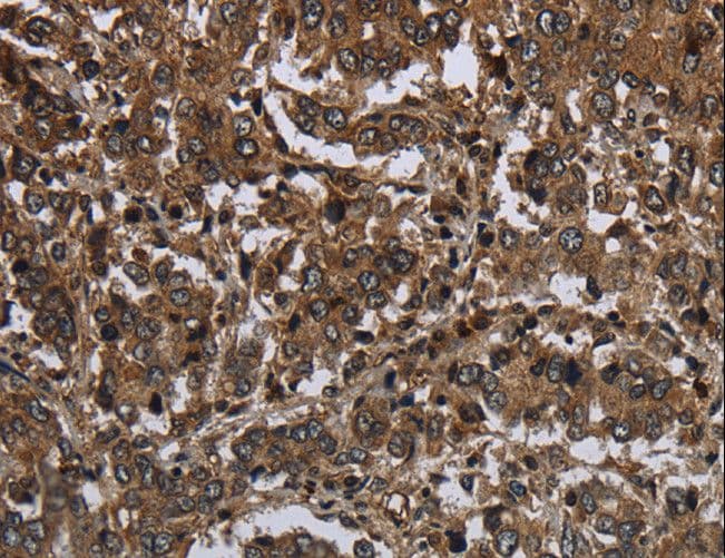 GLIPR1 / GLIPR Antibody